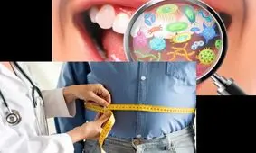 میکروب های دهان می‌توانند کلید پیشگیری از چاقی باشند