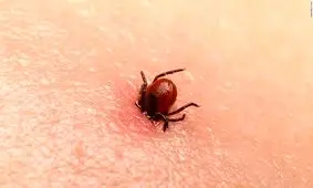 علایم ابتلا به تب خونریزی دهنده کریمه کنگو/ راه‌ های پیشگیری کدامند؟