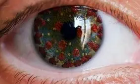 علائم کرونای چشمی را جدی بگیرید