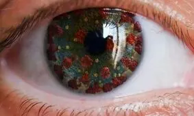 علائم کرونای چشمی را جدی بگیرید