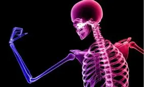 ریزمغذی های مفید برای استخوان ها/ اینفوگرافیک