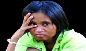 زن جنگلی که ۱۸ سال مثل میمون زندگی کرد/ او هیچ لباسی را نمی‌تواند تحمل کند/ عکس

