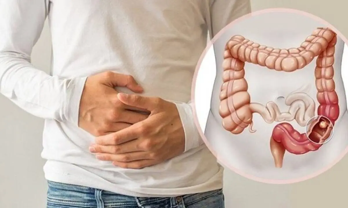 چرا بعضی یبوست‌ها درمان سخت‌تری دارند؟
