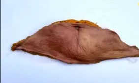  یک زن پوست شکم خود را به چرم انسانی تبدیل کرد!/ عکس
