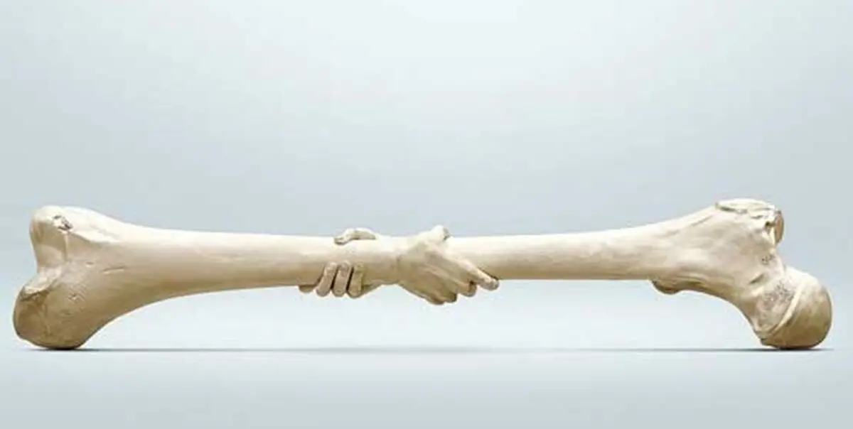 هشدار؛ مصرف خودسرانه کورتون باعث پوکی استخوان می شود!
