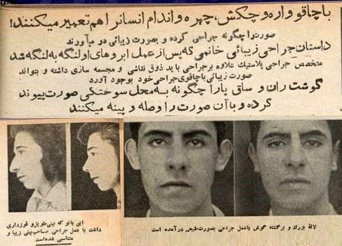 اولین جراحیهای زیبایی در تهران در کدام بیمارستان انجام شد؟