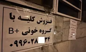 جزییات تکان دهنده از فروش کلیه ۷۰ میلیاردی در تهران