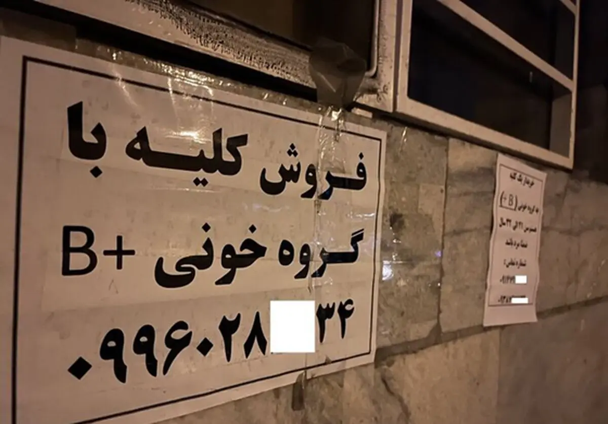 جزییات تکان دهنده از فروش کلیه ۷۰ میلیاردی در تهران