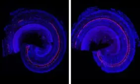 داروی جدید دانشمندان موسسه فناوری ماساچوست آمریکا برای کم‌شنوایی

