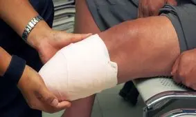 این بیماری می‌تواند منجر به قطع عضو شود