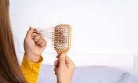 چهار توصیه برای کسانی که ریزش مو دارند
